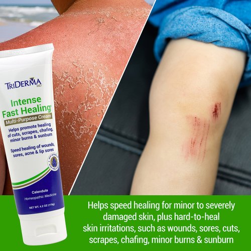 TriDerma Intense Fast Skin Healing Cream for Hard-to-Heal Skin Irritations, Sores, Rashes, Dry, Cracked Hands, Cuts, Chafing, Burns, Scrapes - First Aid Kit Essential - FSA Eligible - 4.0 oz Tube