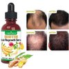 5 PACK Ginger Oil for Hair Growth,Hair Growth Serum,Biotin Hair Growth Oil,Hair Growth Ginger Serum for Men and Women,Hair Growth Treatment,Hair Loss Treatment,Promotes Thicker,Growth Hair