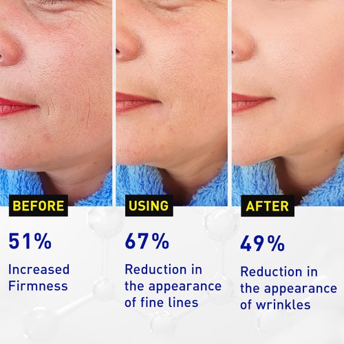 CE Ferulic Vitamin C Serum: Enaskin Naturals Super C Face Serum with Ferulic Acid for Mature Skin, All-in-one Premium Formula for Hydrating, Firming, Smoothing and Anti-aging -1.7 Oz