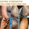 Peeling Oil for Dark Skin, Yellow Peeling Oil, Extra Strong Peeling Oil, Exfoliating Peeling Solution for Body All Skin Type -110ML/3.88 OZ