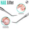 FANDAMEI 4 PCS Nail Care Kit, Cuticle Trimmer, Nail Cuticle Nippers, Ingrown Toenail Tools Kit, Toenail File and Lifters Stainless Steel, Nail Lifter, Nail Cuticle Pushers, Manicure and Pedicure Kit