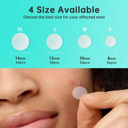 Aquuaera Pimple Patches for Face， Acne Patches/Hydrocolloid Patches for Covering Zits and Blemishes/Acne Treatment for Face，Spot Treatment，Absorb Fluid and Reduce Inflammation,4 size (210 Count)