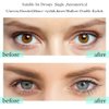 Eyelid Tapes Double Eyelid Sticker - Instant Eye Lid Lift without Surgery