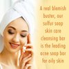 10% Sulfur Soap Cleansing Bar for Face & Body – All Natural Sulfur Facial Cleanser for Acne, Oily Skin – Skincare Blend of Lemongrass, Tea Tree Essential Oil, Vitamin E, Coconut Milk – Sulfur Soap Bar