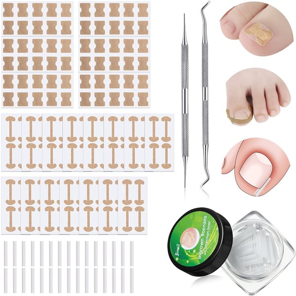 Lanties 152 Pieces Ingrown Toenail Corrector Treatment Tool Sets, Include Curved Toenail Brace Nail Toenail Corrector Sticker, Ingrown Toenail Corrector Strips, Toenail File and Lifter