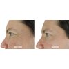 Magic Night Cream-No Needle Alternative-Pure Argireline Peptides Overnight Firming Cream-Argireline, Matrixyl 3000, SNAP-8, Pentapeptide-18 (Leuphasyl), SYN-AKE, Copper Peptide,Syn-Coll, Syn-Tacks
