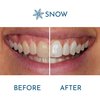 Snow Extra-Strength Teeth Whitening Serum - Oral Care Teeth Whitener Pen - Whitening Pen for Stain Removal & Whiter Teeth - Tooth Whitener with Potassium Nitrate and Hydroxyapatite - 1 Pack