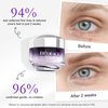 BéLIFACE Eye Cream Anti Aging for Wrinkles with Peptide & Hyaluronic Acid for Fine Lines, Brightening Eye Moisturizer Cream for Women to Reduce Dark Circle with Niacinamide, Paraben Free 1.0 OZ (30g)