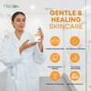 Turmeric Lotion for Dark Spots – Natural Turmeric Skin Brightening Cream for Face & Body – Turmeric Face Cream to Cleanse Skin, Fight Acne, Even Tone, Clear Scars, Sun Damage, & Hyperpigmentation