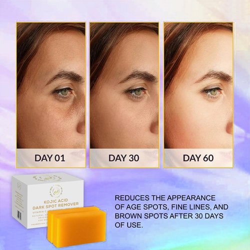 GoldSnailRX-Kojic Acid Soap Dark Spot Remover (Pack of 2) Authentic Kojic Acid Soap For Body Whitening-Japanese Formula Kojic Acid Soap with Vitamin C,Tumeric, infused with Hyaluronic Acid,Shea Butter