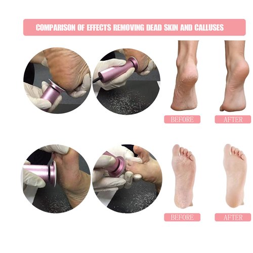 Electric Foot File Callus Remover Professional Foot File Pedicure Tools Adjustable Speed 120pcs Replacement Sandpaper disc Easy to Remove Cutin Dead Skin calluses(Black 120pcs)