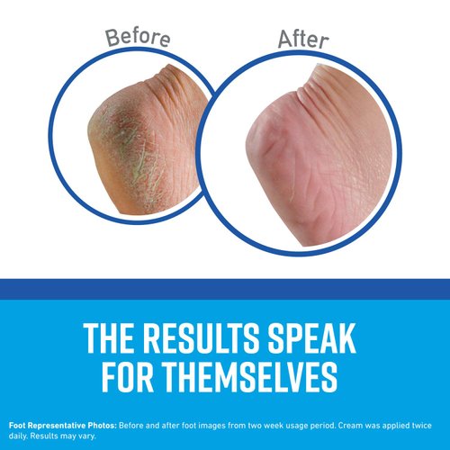 O'Keeffe's K0320001-5 Healthy Feet Foot Cream in Jar (5 Pack), 3.2 oz