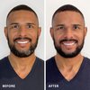 Colorsmith Hair & Beard Color for Full Gray Coverage 2 pack - Dark Intense Copper Blonde - Ammonia-Free Complete Men’s At-home Beard & Hair Dye Kit, Professional-grade Permanent Hair Color (7.40)