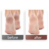 100pcs Foot File Sandpaper Disc with 1 Metal Shaft Replaceable Sanding Pads for Electric Foot Rasp Files Callus Cuticle Hard Dead Skin Removal Pedicure Tools,HJ-NF037 (120 Grit)