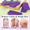 JEFHOMKIT Foot Pumice Stone,40 PCS Pumice Stone for Feet,Disposable Foot Scrubber Pumice Pads,Pumice Stone Dead Skin Callus Remover for Feet,Sponge Pedicure Stone for Nail Salon Home Use(Purple)