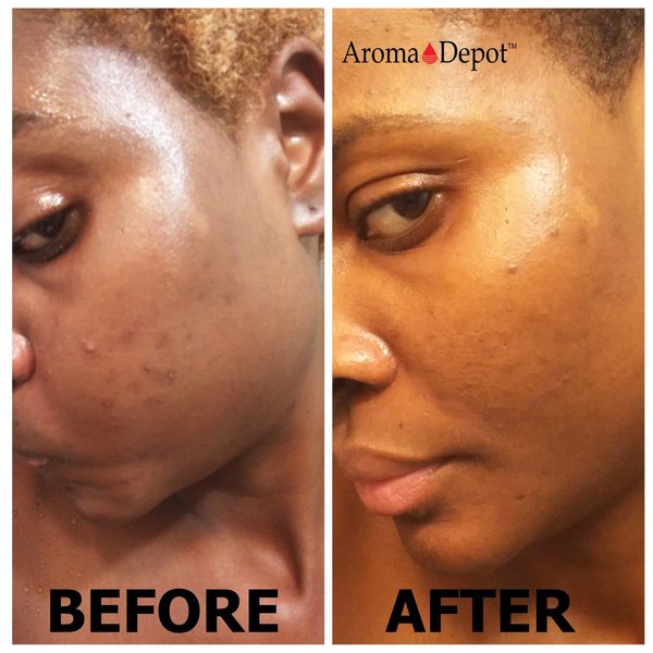 Aroma Depot Lemon Raw African Black Soap 1 lb / 16 oz 100% Natural soap for Acne, Eczema, Psoriasis, Scar Removal Face And Body Wash. Handmade