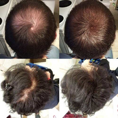 Nor1 Keratin Hair Building Fibers: Hair Fiber Filler and Thickener for Men and Women - Cover Up and Concealer for Thinning Areas or Minor Bald Spot - Thicker, Fuller Hair in Seconds - 25 grams, Grey