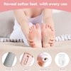 Nuve Smooth Pedicure Wand, Electric Callus Remover for Feet, Portable Smooth Pedicure Stick, Callus Removal Tool, Waterproof, for Treating Dry Cracked Heels, Calluses and Dead Skin.