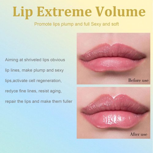 Rosarden Lip Plumper Set - Lip Plumper Extreme - Plumping Lip Gloss - Lip Enhancer Plumper - Lip Moisturizer for Dry Lips - Lip Filler Plumper - Volumize Lips Instantly for Thicker & Fuller Lips