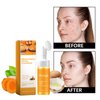 RETZLA Turmeric Facial Cleanser, Turmeric Facial Wash, Turmeric Face Wash, Deep cleansing of facial skin,Turmeric Foaming Cleanser for All Skin