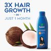 Parachute Advansed Coconut Oil-300ml