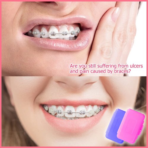 BRMDT Braces Wax, Dental Wax for Braces Moldable Orthodontic Wax for Retainer/Brace Wearers, Food Grade Material (6 Packs)