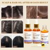 3Pack Hair Oil for Frizzy Hair, Scalp Oil for Hair Growth, 15% Castor Oil Rosemary Oil infused Lightweight Hair Oil for Damaged Hair Organic Black Seed Oil, Repair and Strengthen, Herbal Scent