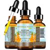 Botanical Beauty CALENDULA OIL Egyptian Calendula Officinalis Marigold Oil Pure Natural for FACE, SKIN, BODY, HAIR, NAILS 1Fl.oz.- 30 ml Skin Moisturizer Oil