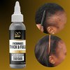 Infinix Scalp & Hair Treatment Pack - Black Seed Oil & Coconut, Aloevera - Promotes Hair Growth - Prevents Hair Thinning - Deep Conditioning - Controls Dandruff - Pack of 2