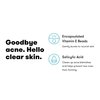 Proactiv Acne Body Wash - Exfoliating Body Wash for Sensitive Skin, Salicylic Acid Cleanser with Soothing Shea Butter & Cocoa Butter - 16 oz.