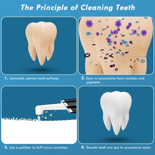 Pelzzle Rechargeable Tooth Polisher Kit for Daily Cleaning, Whitening and Polishing, Electric Dental Teeth Polisher with LED Light, 5 Brush Heads, 5 Speed Modes, Waterproof