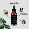 SANOOR® Rosemary Mint, Scalp Hair Growth Oil, Infused Biotin to Encourages Hair Growth | Healthier, Stronger & Long Strands | All Type & Texture | Straight, Waves & Chemically Treated Hairs