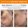 Andalou Naturals Dark Spot Corrector, Brightening Face Serum with Vitamin C, Hyperpigmentation Treatment to Even Skin Tone & May Help Reduce Appearance of Acne Scars, Age Spots & UV Damage, 1 Oz