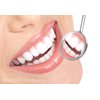 Teeth Whitening Gel Syringe Dispensers 35% Carbamide Peroxide Tooth Bleaching 20 Dispensers 3ml