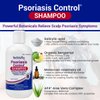 TriDerma Psoriasis Control Scalp Exfoliator Shampoo 8.3 oz and Dry Scalp Moisturizing Hair Conditioner 6.0 oz, Salon Quality Dry Scalp Treatment and Hair Care, Fresh Rosemary Oil, Value Bundle