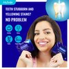 MySmile 7 Treatments Prefilled Teeth Whitening Trays Kit with 12% Hydrogen Peroxide Whiter Gel for Sensitive Tooth, Fast-Result Vegan Teeth Whitener Tooth Stain Remover, Mint Flavor