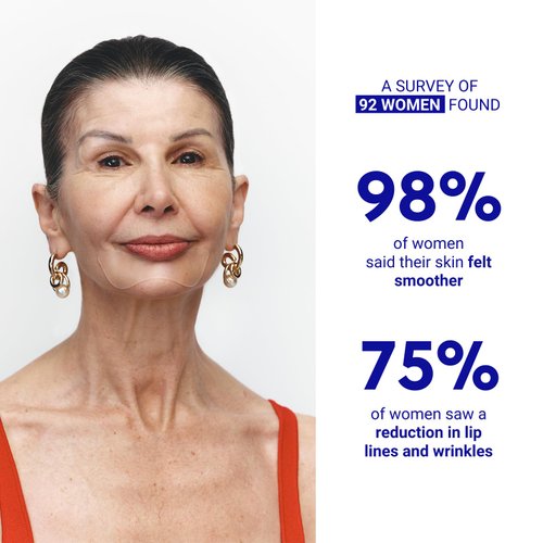 Wrinkles Schminkles Mouth & Lip Wrinkle Patch, 1-Pack, Reusable Hypoallergenic Silicone Smoothing Pads for Lip Wrinkle Prevention