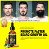 Biotin Beard Growth Oil for Men – Sandalwood Beard Serum with Castor & Grape Seed Oil for Thicker, Softer & Moisturized Beard – Ideal Gift for Father, Husband, Boyfriend – 2 oz