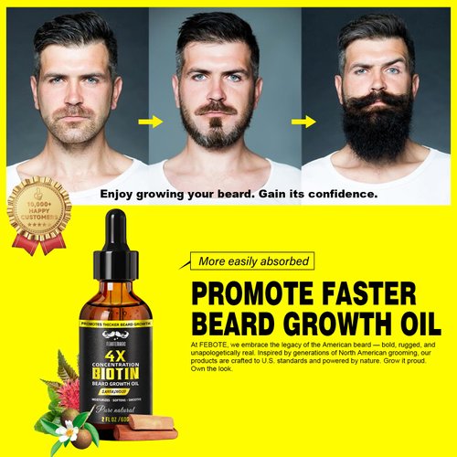 Biotin Beard Growth Oil for Men – Sandalwood Beard Serum with Castor & Grape Seed Oil for Thicker, Softer & Moisturized Beard – Ideal Gift for Father, Husband, Boyfriend – 2 oz