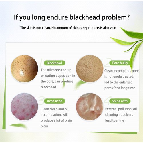 Black Mask, Blackhead Peel Off Mask, Black Mud Deep Cleansing Peel Off Acne Mask Activated Charcoal Tearing Mask for Face Nose (50ml)