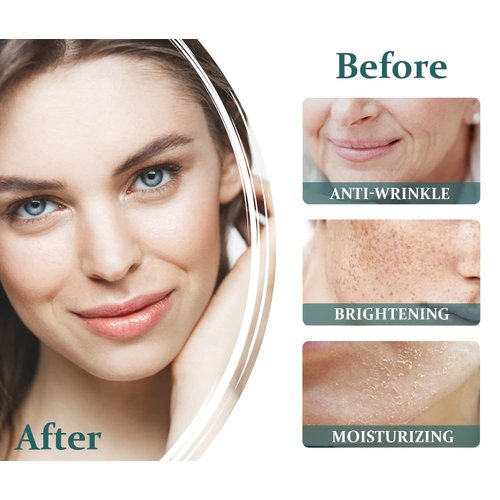 Vollare Cosmetics Face Cream Moisturizer for Women – Facial Hydrating Smoothing Skin Care Products Hyaluronic Acid & Milk Protein – Day & Night Goat's Milk Cream