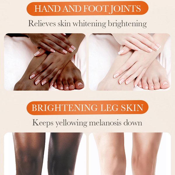 5.2oz Dark Knuckle Whitening Cream,Skin Body Bleaching For Dark Knees and Elbows,Moisturizing Strong Joint Whitening Cream for Clavicle,Neck,Niacinamide Vitamin C Dark Spot Corrector Remover
