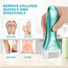 Callus Remover for Feet, Nicebirdie Electric Foot File Callus Removers Rechargeable Waterproof Pedicure Tools Foot Scrubber Shaver Feet Care Tool for Cracked Heels Dead Skin （Blue）