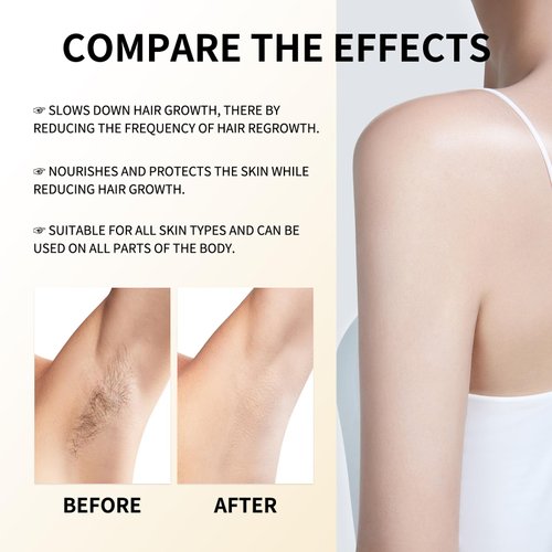 Cyperus Rotundus Oil, Hadea cyperus hair removal oil Natural Hair Removal Solution Reducing Body Hair Growth, Smooth Skin & Moisturizing for All Skin Types