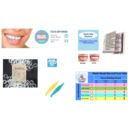 IVORIE Dental Orthodontic Rubber Bands Elastics Braces Teeth Gap 80pcs (5/16" Penguin 4.5oz (High))