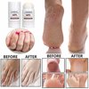 Urea Cream 40 Percent, Urea Foot & Hand Cream for Dry Cracked, Urea Cream Stick, 40 per Urea Lotion for Feet Dead Skin Remover, Softener for Feet Care, Maximum Strength Foot Moisturizer