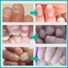 MIELIKKI Nail Repair Cream, Nail Strengthener Cream, Nail Repair Solution, Repairs Damaged, Broken, Cracked and Discolored Nails
