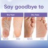 Foot Peel Mask (2 Pairs) - for Baby Soft Skin Remove Dead Skin, Dry, Cracked Feet & Callus, Spa, Made with Aloe Vera Extract Women and Men Peeling Exfoliating, Lavender
