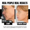 FIT FACE X The Gym For Your Face / 4 Face Sculpting Tools In The Box/Jowl Tighter/Lip Plumper/Double Chin & Jaw Exerciser/For Women & Men