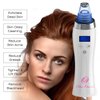 Blackhead Remover Pore Vacuum for face, BlueOrchids dermasuction for Whitehead Removal, Acne Pimple Sucker, face Vacuum Pore Cleanser, Comedone Extractor, 5 Adjustable Suction Power with 4 Probes